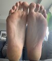 22_Joey_Kidney_Feet_5595557.jpg